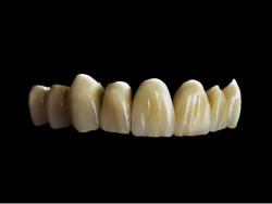<h1>Ceramic Dental Implant Manufacturer: Revolutionizing Dental Care</h1>