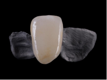 <h1>Ceramic Dental Implant Manufacturer: Revolutionizing Dental Care</h1>